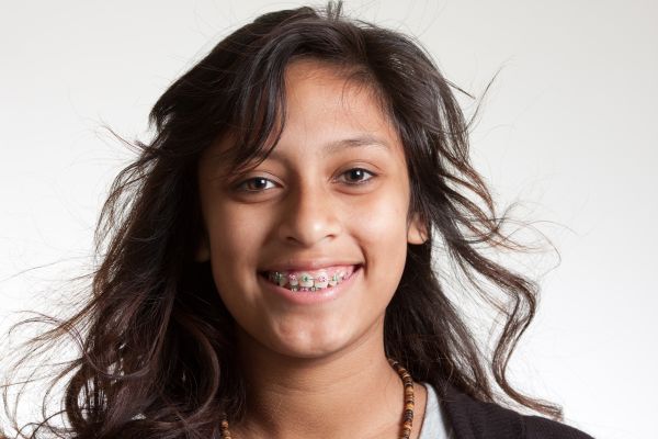 Common Questions Parents Have About Children&#    ;s Braces
